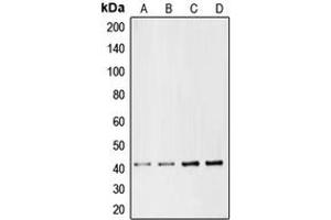 Western blot analysis of CMKLR1 expression in Jurkat (A), HepG2 (B), mouse liver (C), rat liver (D) whole cell lysates. (CMKLR1 antibody  (Center))
