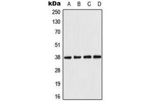Western blot analysis of AMPK beta 1 expression in HeLa (A), Raw264. (PRKAB1 antibody  (N-Term))