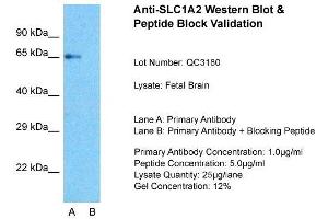 SLC1A2 antibody  (N-Term)