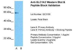 SLC1A2 antibody  (N-Term)