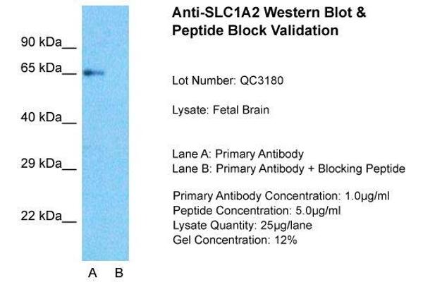 SLC1A2 antibody  (N-Term)