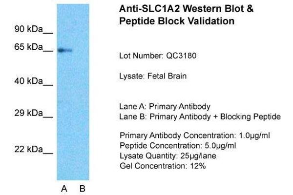 SLC1A2 抗体  (N-Term)