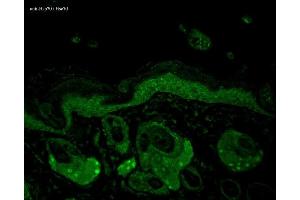 Immunohistochemistry analysis using Mouse Anti-Hsp70 Monoclonal Antibody, Clone N27F3-4 (ABIN361705 and ABIN361706). (HSP70/HSC70 antibody)