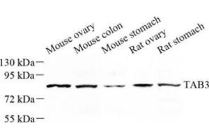 Western blot analysis of tab3 (ABIN7075877) at dilution of 1: 500