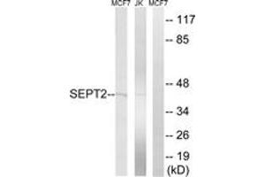 Western blot analysis of extracts from Jurkat/MCF-7 cells, using SEPT2 Antibody.