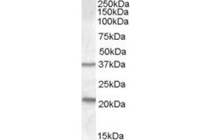 TUSC3 antibody  (Internal Region)