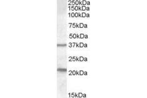 ABIN334520 (1µg/ml) staining of Human Liver lysate (35µg protein in RIPA buffer). (TUSC3 antibody  (Internal Region))