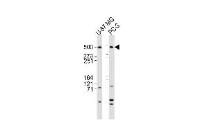 All lanes : Anti-DYNC1H1 Antibody (C-term) at 1:2000 dilution Lane 1: U-87 MG whole cell lysates Lane 2: PC-3 whole cell lysates Lysates/proteins at 20 μg per lane. (DYNC1H1 antibody  (C-Term))
