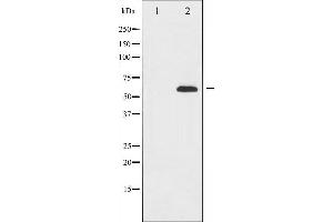 Western blot analysis of FOXO4 expression in K562 whole cell lysates,The lane on the left is treated with the antigen-specific peptide. (FOXO4 antibody  (C-Term))