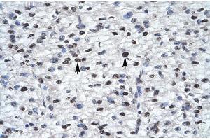 Rabbit Anti-GLI2 Antibody  Paraffin Embedded Tissue: Human Heart Cellular Data: Myocardial cells Antibody Concentration: 4. (GLI2 antibody  (Middle Region))