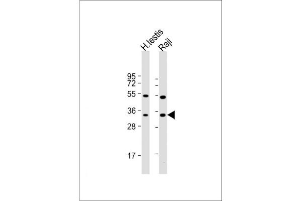 HSD17B3 antibody  (AA 89-118)