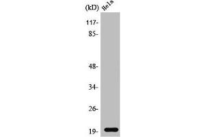 Western Blot analysis of Jurkat cells using SRp20 Polyclonal Antibody (SRSF3 antibody  (C-Term))