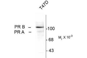 Western Blotting (WB) image for anti-Progesterone Receptor (PGR) (pSer294) antibody (ABIN371835) (Progesterone Receptor antibody  (pSer294))