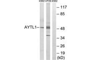 Western blot analysis of extracts from K562/HT-29 cells, using LPCAT2 Antibody.