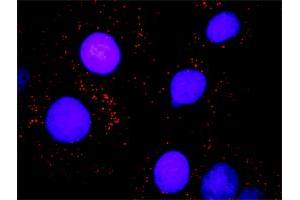 Proximity Ligation Analysis of protein-protein interactions between SMARCB1 and BAZ1B. (BAZ1B antibody  (AA 1384-1483))