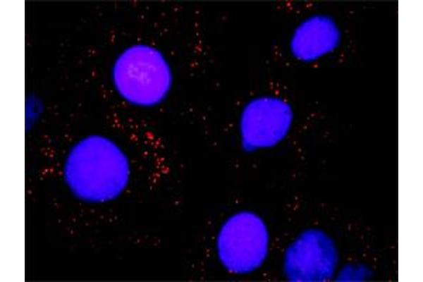 BAZ1B antibody  (AA 1384-1483)