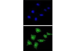 Confocal immunofluorescent analysis of SOD1 antibody with 293 cells followed by Alexa Fluor 488-conjugated goat anti-rabbit lgG (green). (SOD1 antibody  (AA 55-84))