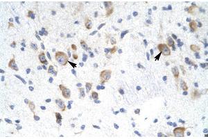 Human Brain; Rabbit Anti-GTF2F2 Antibody. (GTF2F2 antibody  (Middle Region))