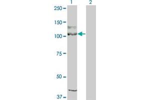 Western Blot analysis of KIT expression in transfected 293T cell line by KIT monoclonal antibody (M04), clone 1G1. (KIT antibody  (AA 41-140))