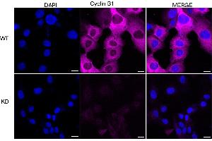 anti-Cyclin B1 (CCNB1) antibody