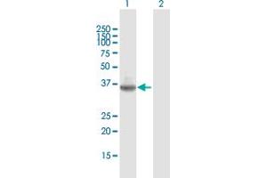 Western Blot analysis of TMIGD2 expression in transfected 293T cell line by TMIGD2 MaxPab polyclonal antibody. (TMIGD2 antibody  (AA 1-282))