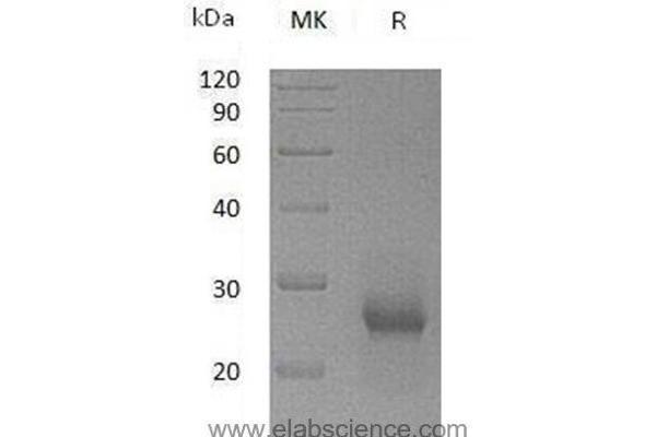TIMP1 Protein