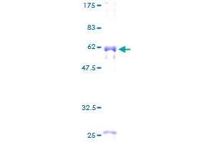 MYOZ2 Protein (AA 1-264) (GST tag)