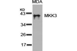 Image no. 3 for anti-Mitogen-Activated Protein Kinase Kinase 3 (MAP2K3) (Ser189) antibody (ABIN197296) (MAP2K3 antibody  (Ser189))