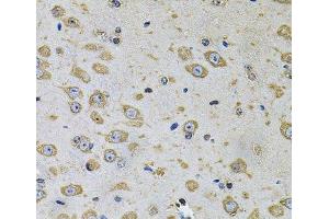 Immunohistochemistry of paraffin-embedded Rat brain using RhoA Polyclonal Antibody at dilution of 1:100 (40x lens). (RHOA antibody)