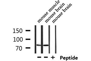 Western blot analysis of extracts from mouse muscle and mouse brain, using USP51 Antibody. (USP51 antibody)