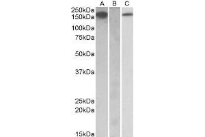 HEK293 lysate (10ug protein in RIPA buffer) overexpressing Human CSF1R with C-terminal MYC tag probed with ABIN571222 (1ug/ml) in Lane A and probed with anti-MYC Tag (1/1000) in lane C. (CSF1R antibody  (AA 734-744))