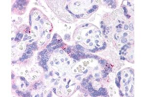 ABCB1 antibody was used for immunohistochemistry at a concentration of 4-8 ug/ml. (ABCB1 antibody)