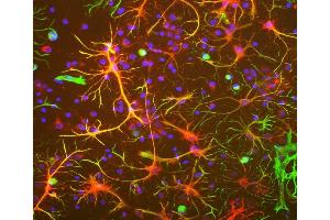 Neuron-glia cell mixed cultures stained with ABIN1842234 (red) and our chicken polyclonal antibody against vimentin: CPCA-Vim (green). (Aldehyde Dehydrogenase H1L1 antibody)