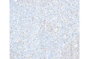 Immunohistochemistry (IHC) image for anti-Spleen Focus Forming Virus (SFFV) Proviral Integration Oncogene Spi1 (SPI1) (AA 1-50) antibody (ABIN7455165)