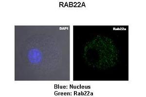 Lanes: Murin JAWS-II cells Primary Antibody Dilution: 1:1000Secondary Antibody: Anti-rabbit-FITC Secondary Antibody Dilution: 1:0500  Gene Name: Blue: Nucleus Green: Rab22a Submitted by: RAB22A (RAB22A antibody  (Middle Region))