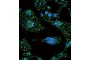 Immunofluorescence (IF) image for anti-Notch 3 (NOTCH3) antibody (ABIN3002554) (NOTCH3 antibody)