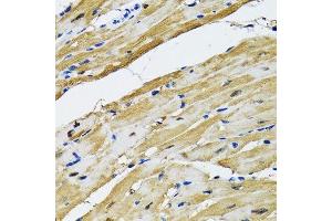 Immunohistochemistry of paraffin-embedded rat heart using GOT1 antibody. (GOT1 antibody  (AA 244-413))