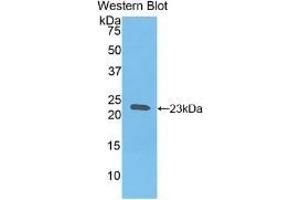 Detection of Recombinant HBb, Gallus using Polyclonal Antibody to Hemoglobin Beta (HBb)