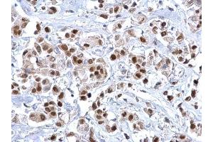Immunohistochemistry (IHC) image for anti-Forkhead Box A1 (FOXA1) (C-Term) antibody (ABIN2854707)