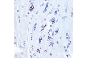 Immunohistochemistry of paraffin-embedded rat brain using YB-1/YBX1 Rabbit mAb (ABIN7271410) at dilution of 1:100 (40x lens). (YBX1 antibody)