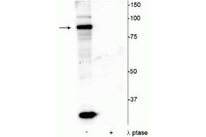 Western blot of mouse testicular lysate showing specific immunolabeling of the ~86 kDa ATRIP protein phosphorylated at Ser239 in the first lane (-). (ATRIP antibody  (pSer239))