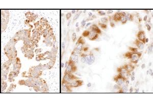 Immunohistochemistry (IHC) image for anti-Isocitrate Dehydrogenase 2 (NADP+), Mitochondrial (IDH2) (AA 402-452) antibody (ABIN7455220) (IDH2 antibody  (AA 402-452))