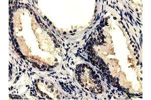 Immunohistochemical staining of paraffin-embedded Human prostate tissue using anti-CBWD1 mouse monoclonal antibody. (CBWD1 antibody)