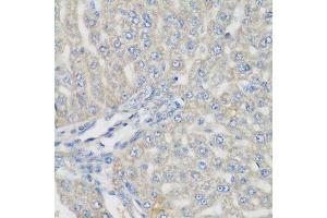 Immunohistochemistry of paraffin-embedded rat liver using METTL7A antibody. (METTL7A antibody  (AA 30-244))