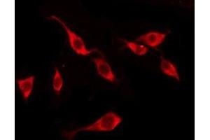 ABIN6276219 staining LOVO by IF/ICC. (TAS2R10 antibody  (Internal Region))