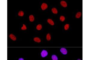 Confocal immunofluorescence analysis of U-2 OS cells using CTCF Polyclonal Antibody at dilution of 1:100. (CTCF antibody)