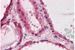 Human Thyroid (formalin-fixed, paraffin-embedded) stained with PAFAH1B1 antibody ABIN364420 at 3. (PAFAH1B1 antibody  (AA 397-410))