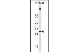Western blot analysis in mouse liver tissue lysates (35ug/lane). (UBE2W antibody  (C-Term))