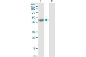 Western Blot analysis of FCER2 expression in transfected 293T cell line by FCER2 monoclonal antibody (M04A), clone S51. (FCER2 antibody  (AA 1-321))
