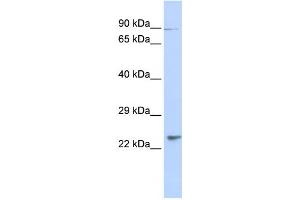 Western Blotting (WB) image for anti-Leucine Rich Transmembrane and 0-Methyltransferase Domain Containing (LRTOMT) antibody (ABIN2459913) (Leucine Rich Transmembrane and 0-Methyltransferase Domain Containing (LRTOMT) antibody)
